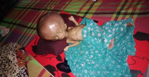 কাউনিয়ায় টাকার অভাবে থেমে গেছে ৫ মাসের শিশু আসছিয়া জান্নাতের চিকিৎসা